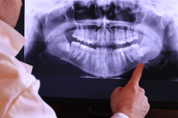Best Cracked Tooth Emergency Dentist  in Fort Polk South, LA