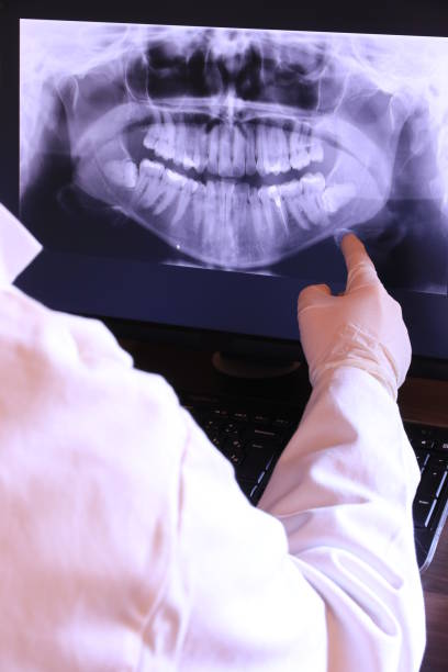 Best Knocked-Out Tooth Emergency  in Fort Polk South, LA
