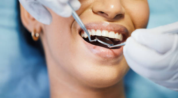Best Dentist for Tooth Abscess  in Fort Polk South, LA